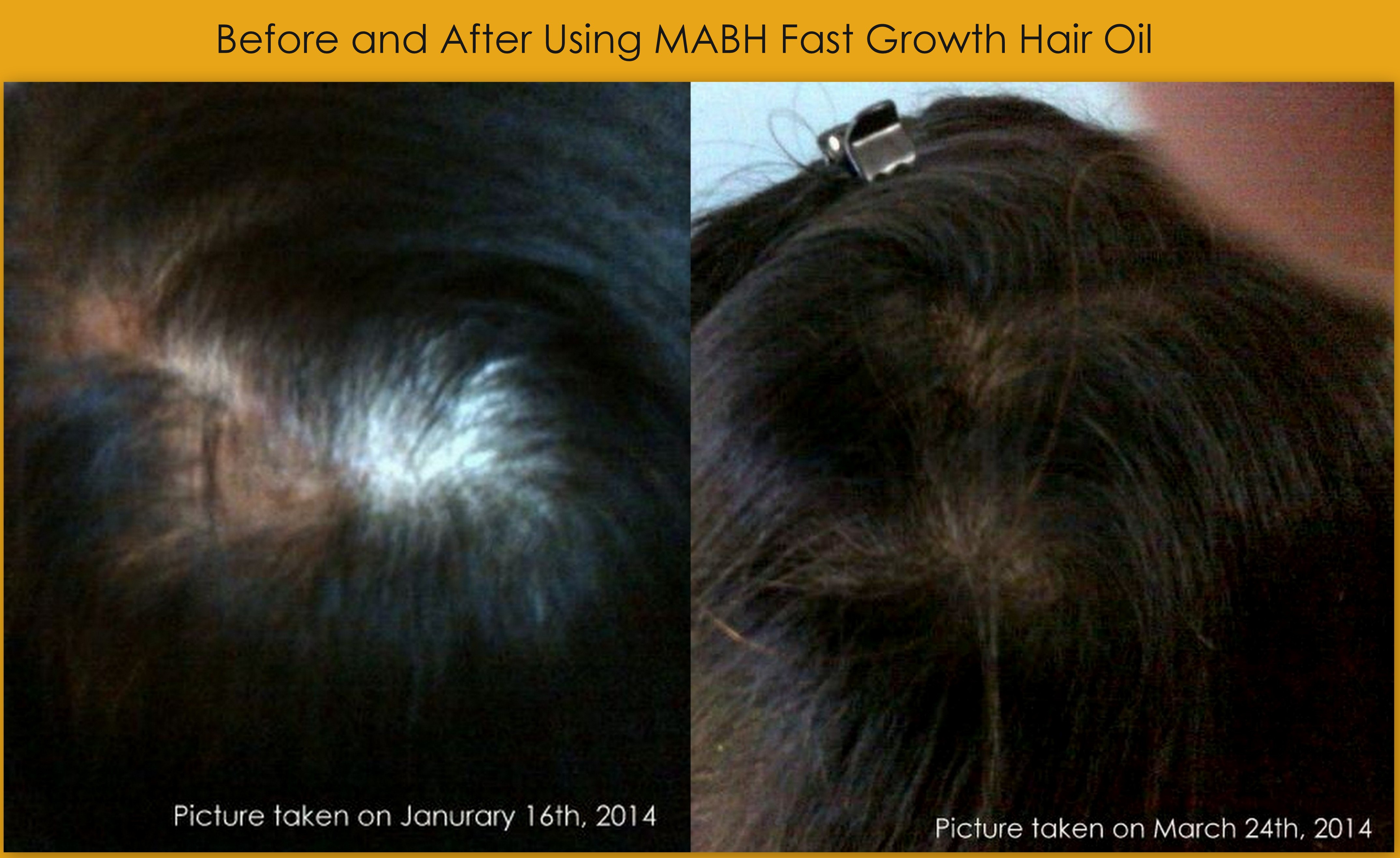 before and after using mabh fast growth hair oil