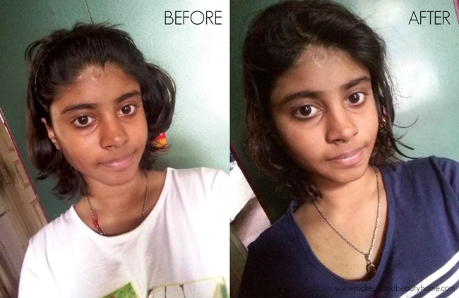 before and after tan removal face pack
